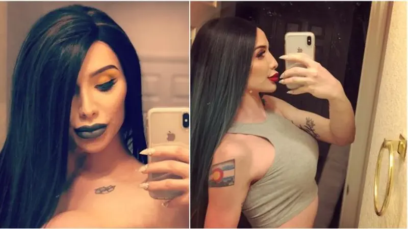 Ingin Seperti Kylie Jenner, Transgender Ini Habiskan Uang Hingga Satu Miliar Untuk Operasi Plastik