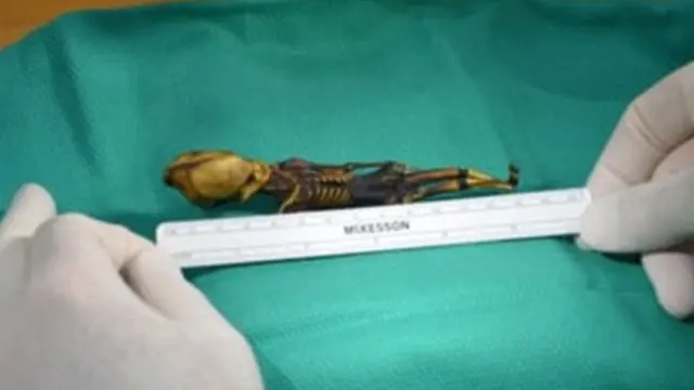 Dikira Alien, Mumi Berkepala Kerucut Ternyata Bayi Perempuan Berpenyakit Langka