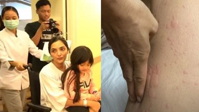 6 Potret Kondisi Ashanty Saat Dirawat, Jalani Operasi Hingga Dijenguk Millendaru