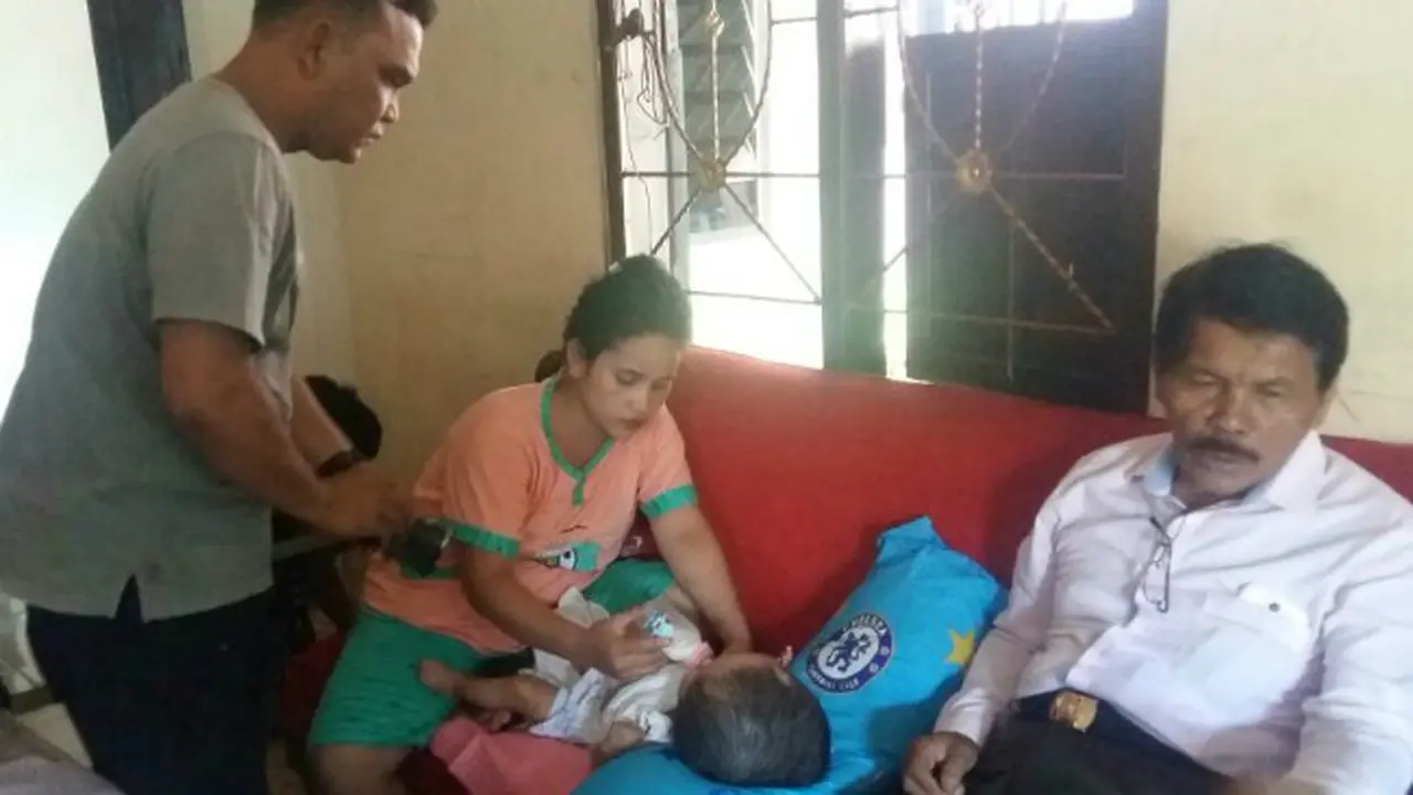 Bayi Mengidap Hydrocephalus di Padangsidimpuan Butuh Bantuan
