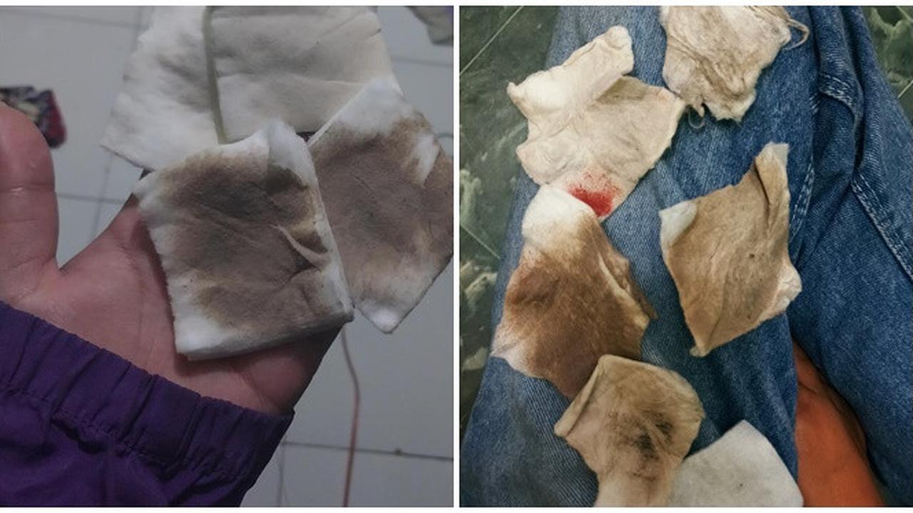 6 Potret Wajah Kotor karena Polusi Udara Ini Bikin Elus Dada