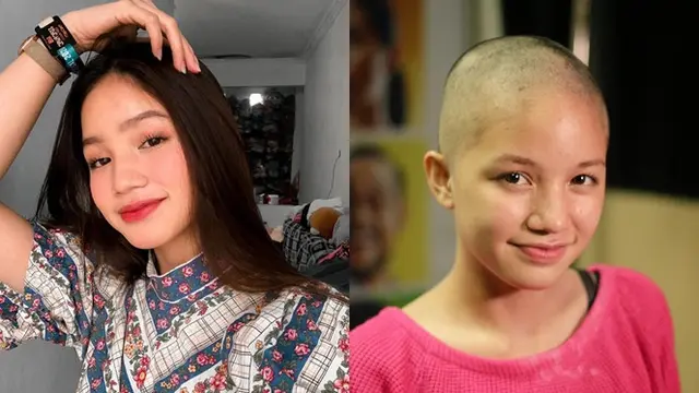 Selain Megan Domani, 6 Aktris Ini Totalitas Tampil Botak Demi Peran