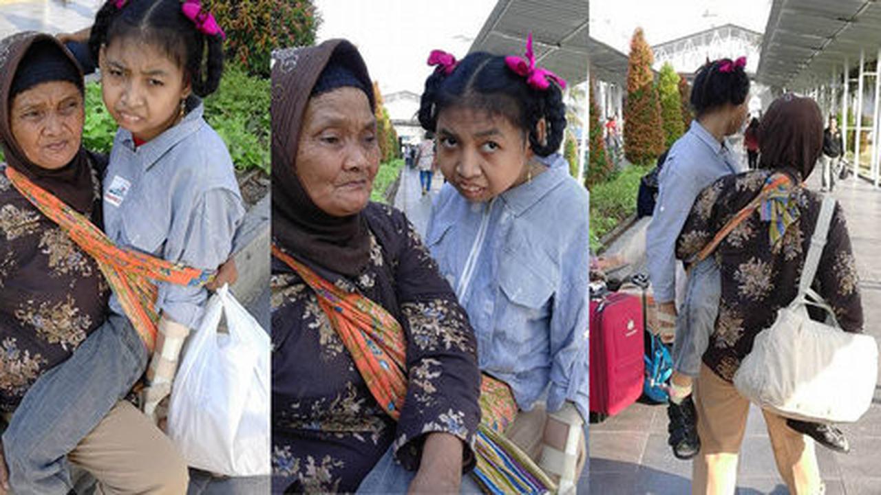 Kisah nenek gendong cucu usia 18 tahun dari Bogor berobat ke RSCM