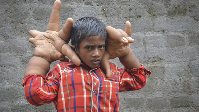Tangan Raksasa