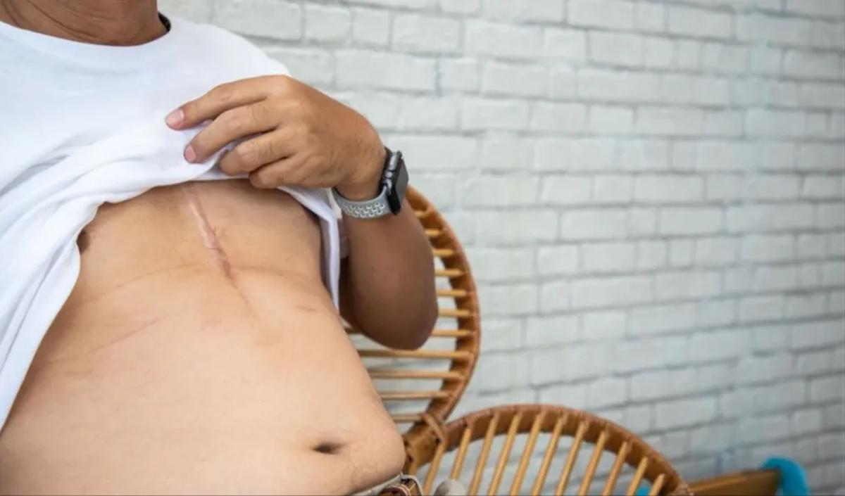 Sebegai informasi, katup aorta berperan untuk mengatur aliran darah dari jantung ke seluruh tubuh.&nbsp;<br>