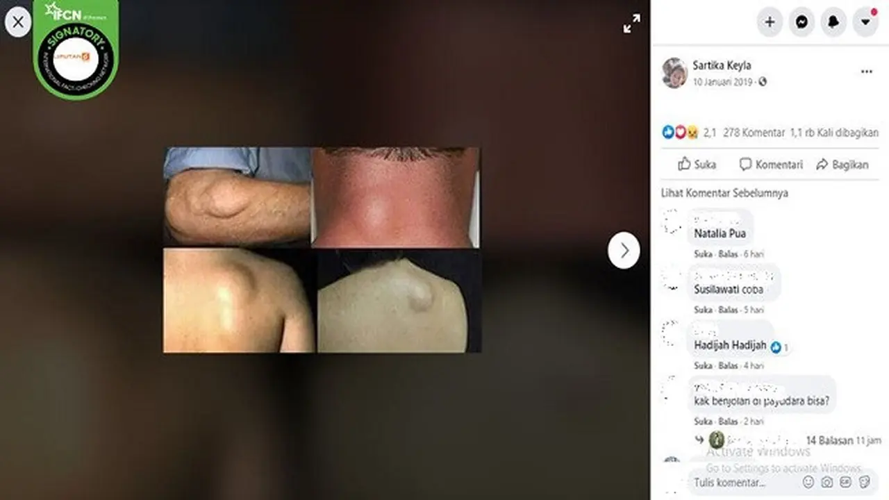 Gambar Tangkapan Layar Foto yang Diklaim Kanker Getah Bening