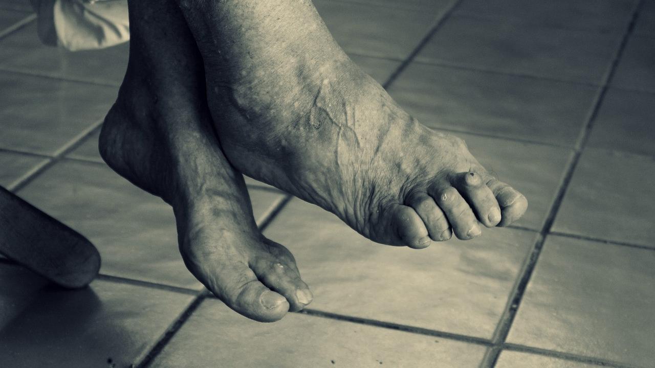 4 Cara Cegah Osteoporosis Sejak Dini, Salah Satunya Olahraga Teratur