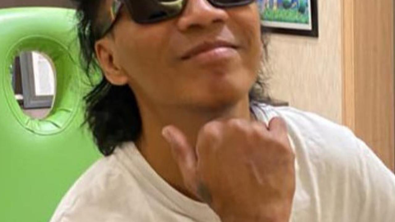 7 Potret Terbaru Kaka Slank yang Beda Banget dan Bikin Pangling, Ternyata Lakukan Treatment Implan Rambut