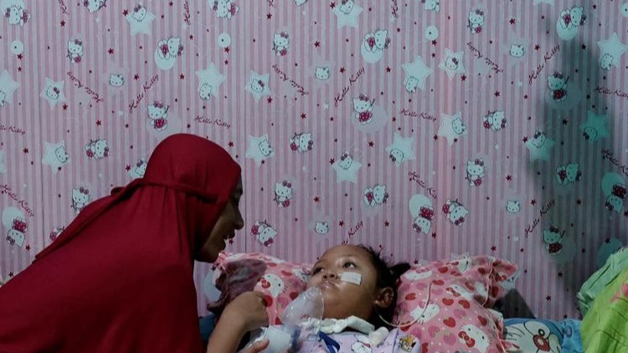 Mereka terpaksa harus menggunakan alat bantu medis agar bisa bertahan hidup. <br>