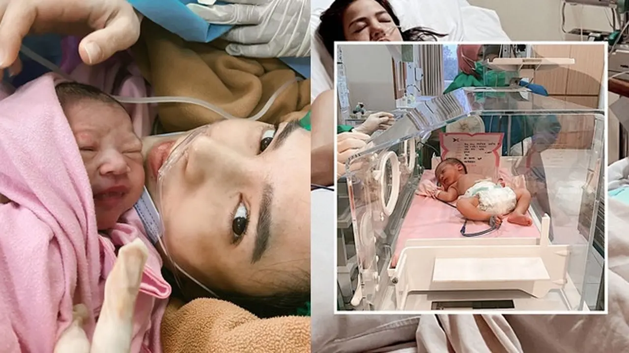 Pendarahan 3 Liter, Ini 6 Potret Perjuangan Alice Norin Melahirkan Anak Kedua
