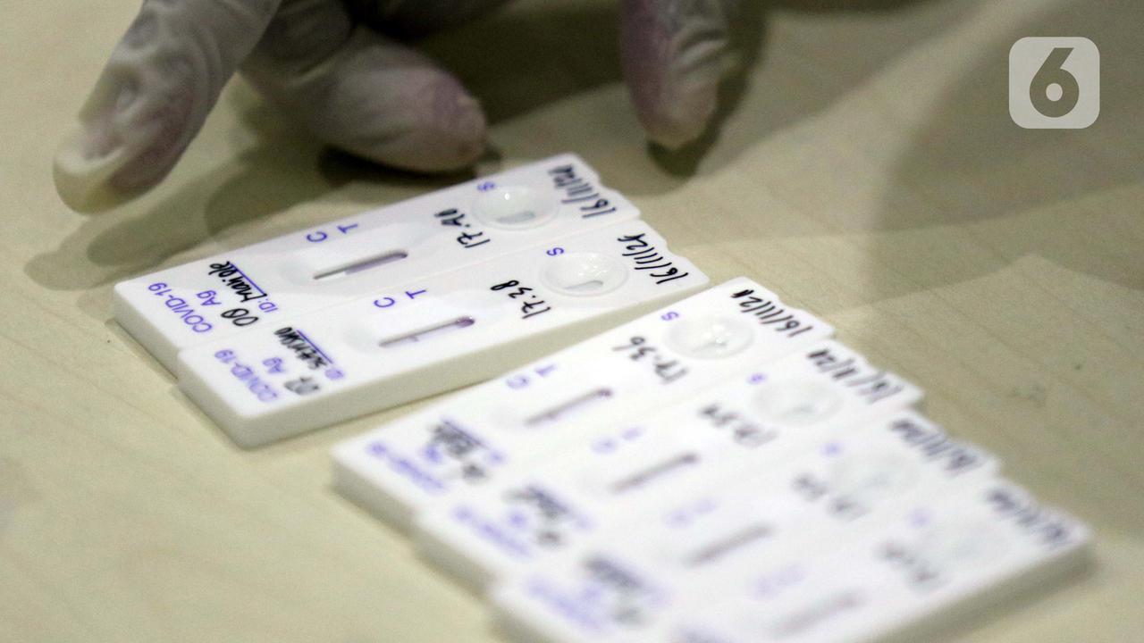 FOTO: Cegah Penyebaran COVID-19, Pewarta Jalani Rapid Test Antigen