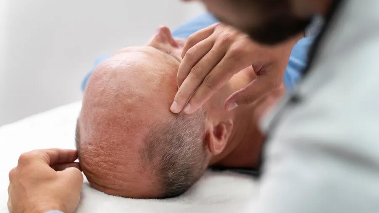 Efek Samping Pengobatan dan Terapi: Peran Obat-obatan dalam Kebotakan