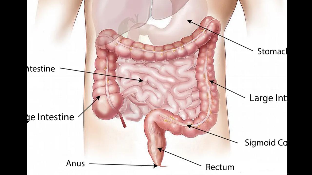 Antraks Gastrointestinal