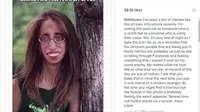 Seorang wanita yang fotonya dijadikan meme ejekan karena fisiknya, mendapat ribuan dukungan dari warganet untuk berhenti berbagi gambar ters