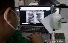 Waspada! Batuk Lama dan Berat Badan Turun Bisa Jadi Gejala Awal TBC