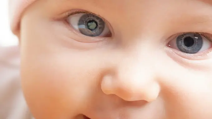 [Bintang] Mengenal Katarak, Penyakit yang Diderita Anak Asri Welas