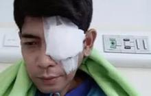 Lama Tak Terdengar Kabarnya, Begini Kondisi Veri AFI Usai Jalani Operasi Mata Kiri