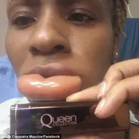 Girls! Jangan sampai kamu mengalami alergi lipstik kayak Lily, perempuan asal Florida, AS ini, ya.. (Via: dailymail.co.uk)