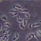 Foto Naegleria fowleri, amoeba pemakan otak. Dok: CDC AS