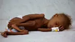 Seorang anak tergeletak di tempat tidur di unit malnutrisi perawatan intensif di sebuah rumah sakit di kota pelabuhan Laut Merah dari Hodaida, Yaman pada 11 September 2016. (REUTERS/Khaled Abdullah)