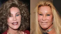 Profil Jocelyn Wildenstein 'Catwoman' yang Meninggal Dunia, Sosialita Asal Swiss Penggila Operasi Plastik