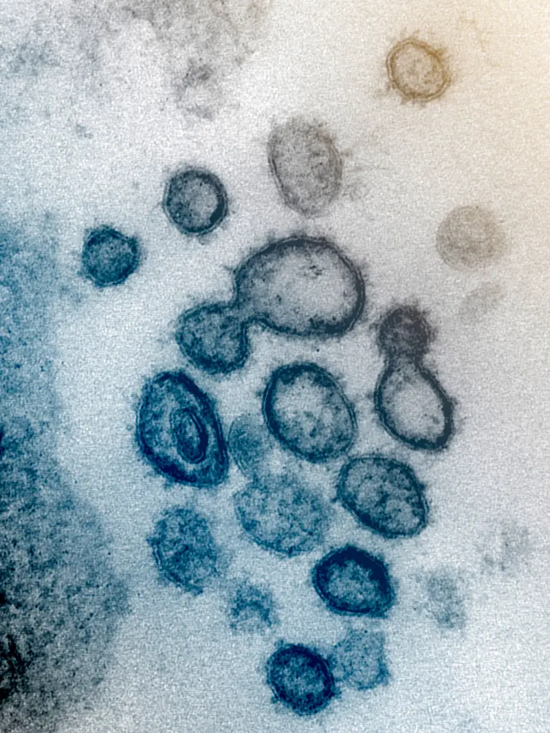 Virus Corona COVID-19 dari Mikroskop
