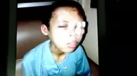 Seorang PRT Ditemukan Babak Belur di Rumah Kakak Majikan
