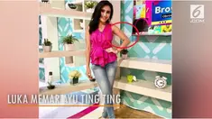 Ayu Ting Ting diduga mendapat luka memar dari insiden sebuah acara yang ia pandu.