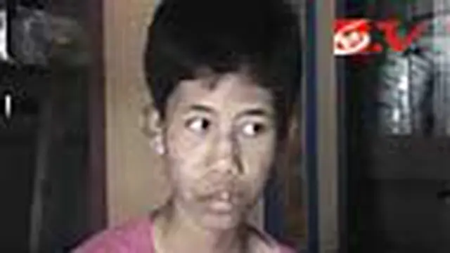 Kondisi Yunita Sari Masih Lemah