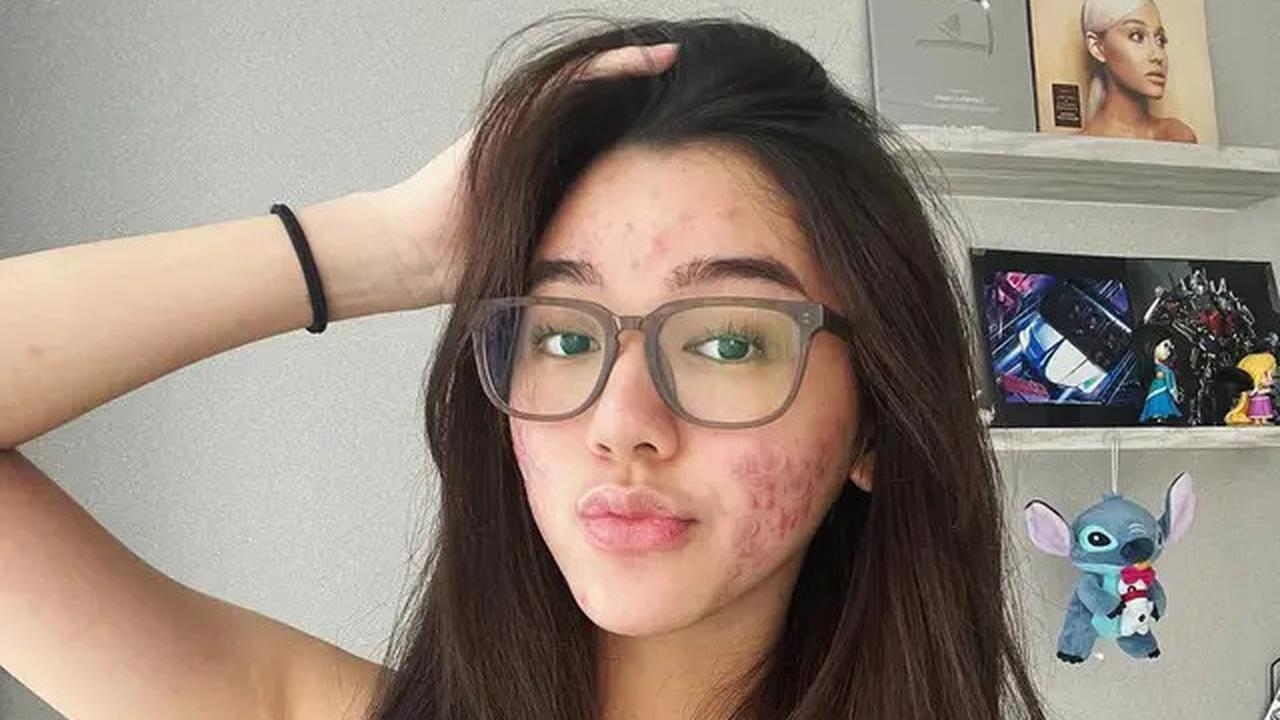 Intip Potret Terbaru Gabriella Ekaputri yang Menginspirasi untuk MencintaiDiriSendiri