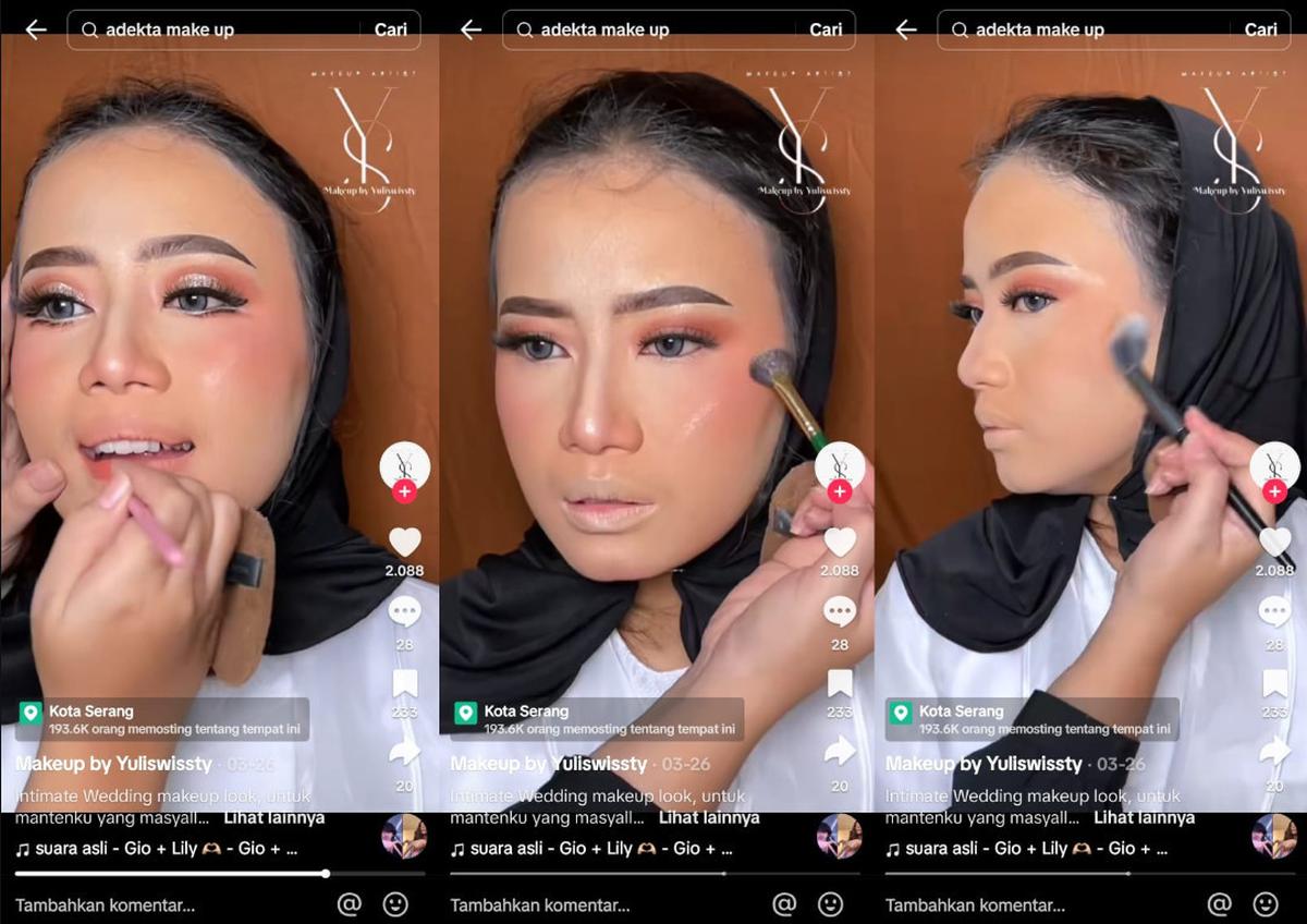 Finishing: Riasan Pengantin untuk Penderita Vitiligo
