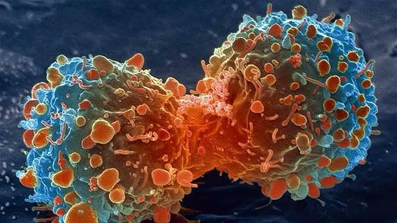 Efektifkah Pengobatan Nuklir Untuk Kanker?