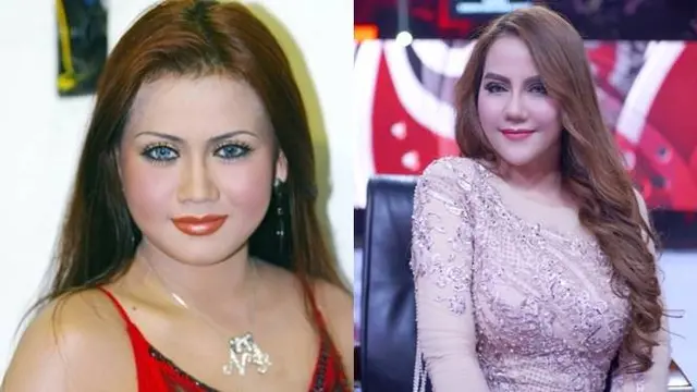 7 Transformasi Seleb Sebelum dan Sesudah Operasi Plastik, Bikin Pangling