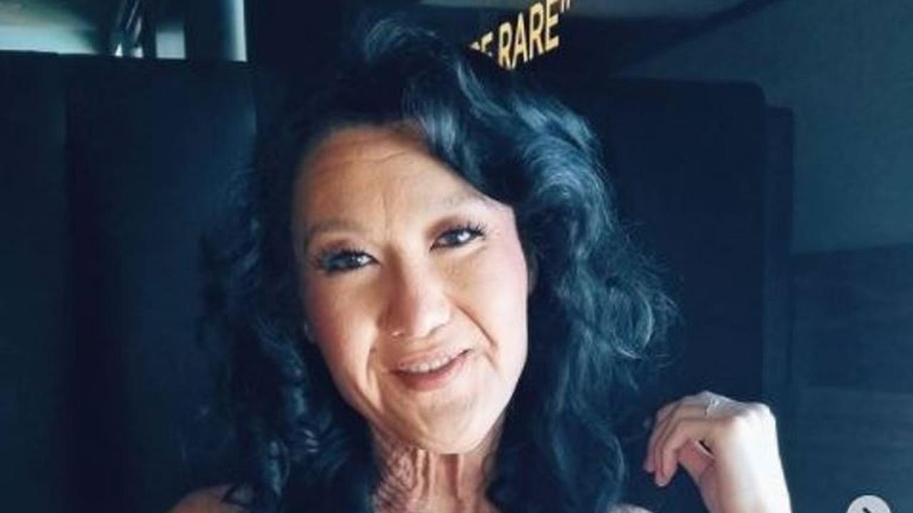 Cerita Wanita yang Kulitnya Sudah Keriput di Usia 20an Tapi Jadi Model