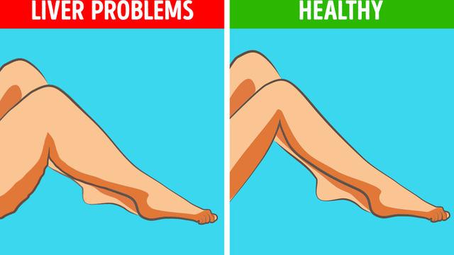 Kaki Sakit Gejala Penyakit Serius