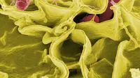 Ilustrasi bakteri Salmonella. (dok. WikiImages/Pixabay.com)