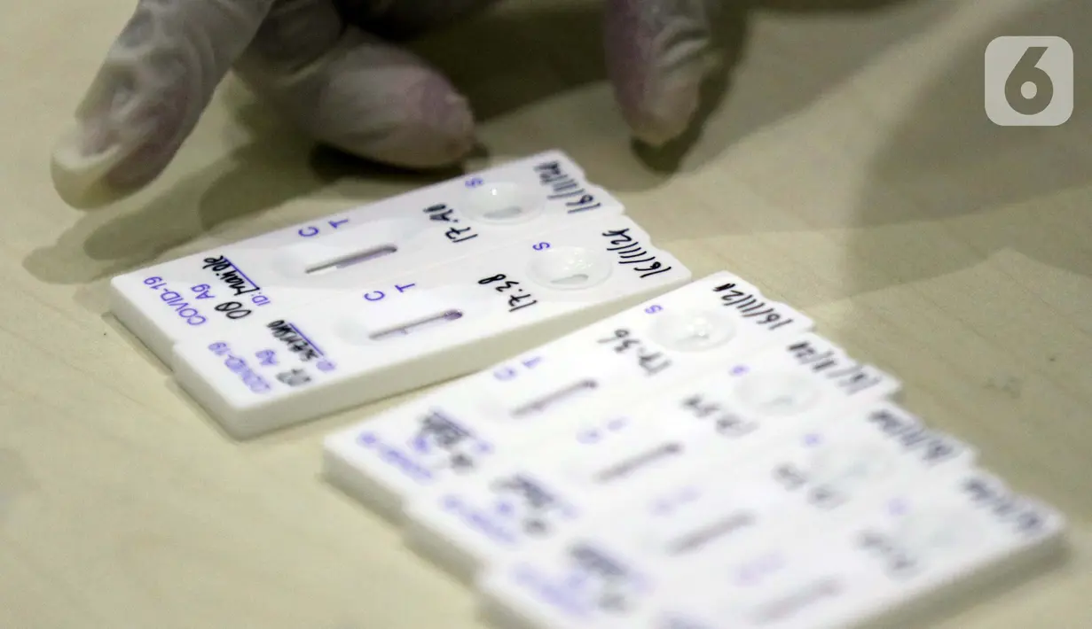 Petugas medis mengecek hasil rapid test antigen di ruang wartawan Gedung KPK, Jakarta, Senin (16/11/2020). Sejak diumumkan pertama kali pada Maret 2020 hingga Senin (16/11) kasus konfirmasi positif Covid-19 di Indonesia secara keseluruhan mencapai 470.648 kasus. (Liputan6.com/Helmi Fithriansyah)