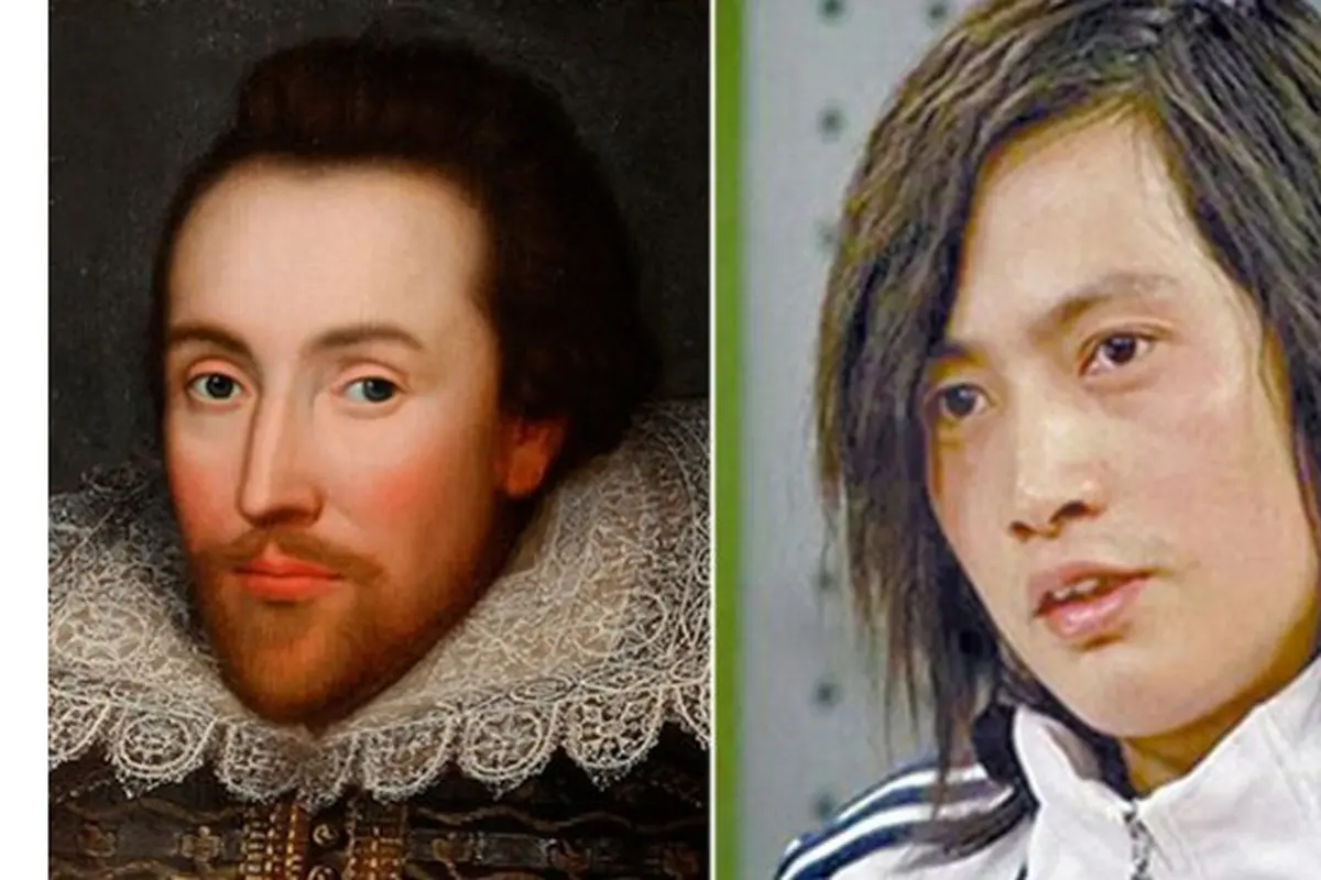 Penggemar William Shakespeare, Pria Ini Operasi Plastik Wajahnya
