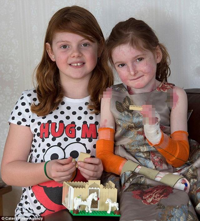 Isla bersama saudara perempuannya | Photo: Copyright dailymail.co.uk