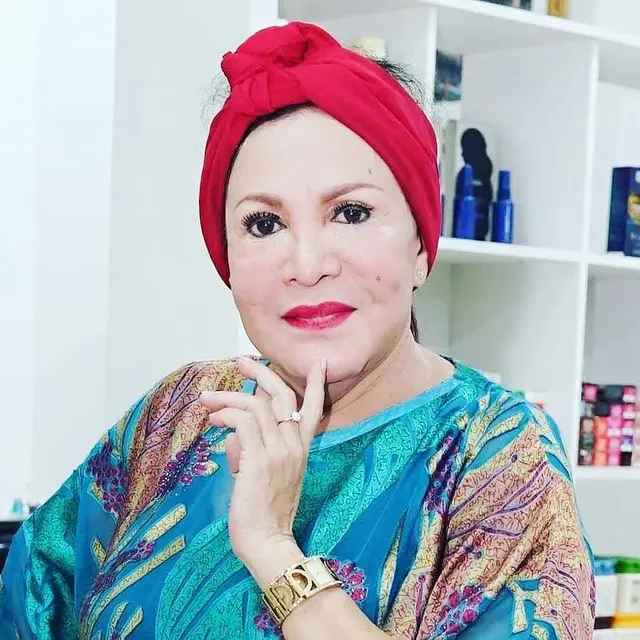 Pernah Jalani Operasi Pengangkatan Silikon Ini 6 Potret Terbaru Mpok Atiek