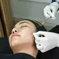 Treatment untuk Mengatasi Melasma atau Flek Hitam Bersama Qeza Aesthetic Clinic. foto: istimewa