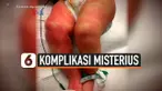 komplikasi misterius
