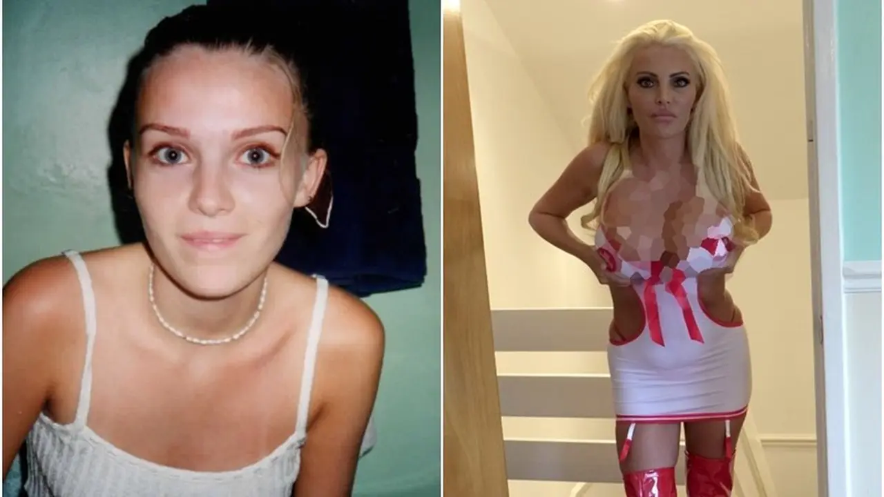Ingin Miliki Tubuh bak Barbie, Amanda Hamburkan Rp 2M