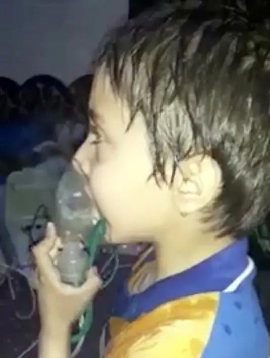Seorang balita menghirup oksigen setelah diduga terkena serangan senjata kimia di Kota Douma, dekat Damaskus, Suriah, Minggu (8/4). Tim medis mengatakan korban kesulitan bernapas dan mata seperti terbakar. (Syrian Civil Defense White Helmets via AP)