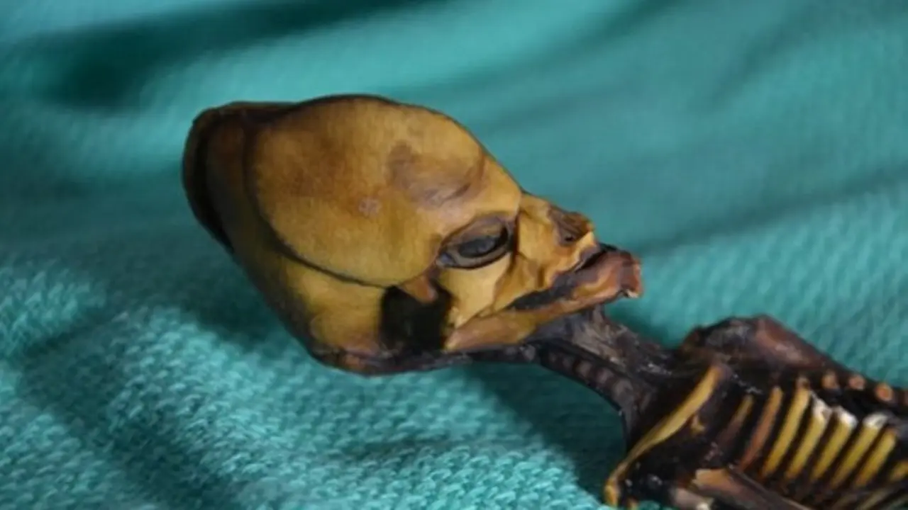 Dikira Alien, Mumi Berkepala Kerucut Ternyata Bayi Perempuan Berpenyakit Langka