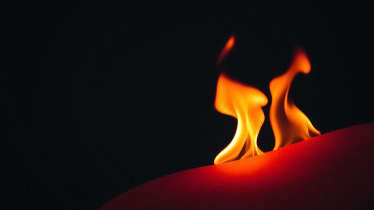 Luka Bakar Tak Ditangani, Ini 7 Dampak yang Bisa Terjadi