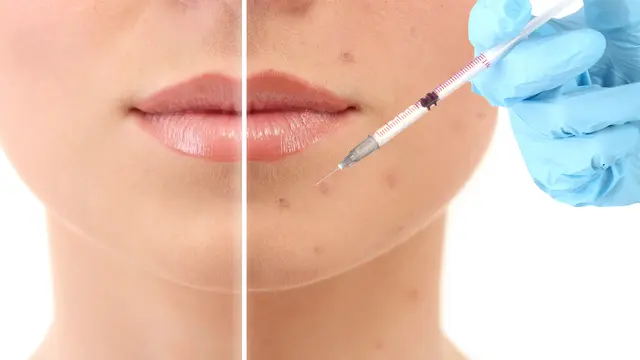 ilustrasi injeksi/shuttershock