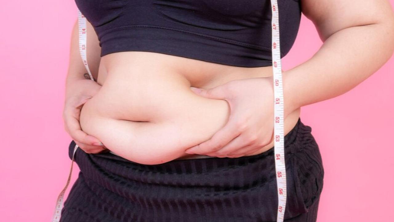 obesitas