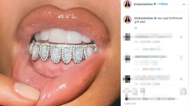Hiasan Gigi Kim Kardashian Terbuat dari Opal dan Berlian, Berapa Harganya?