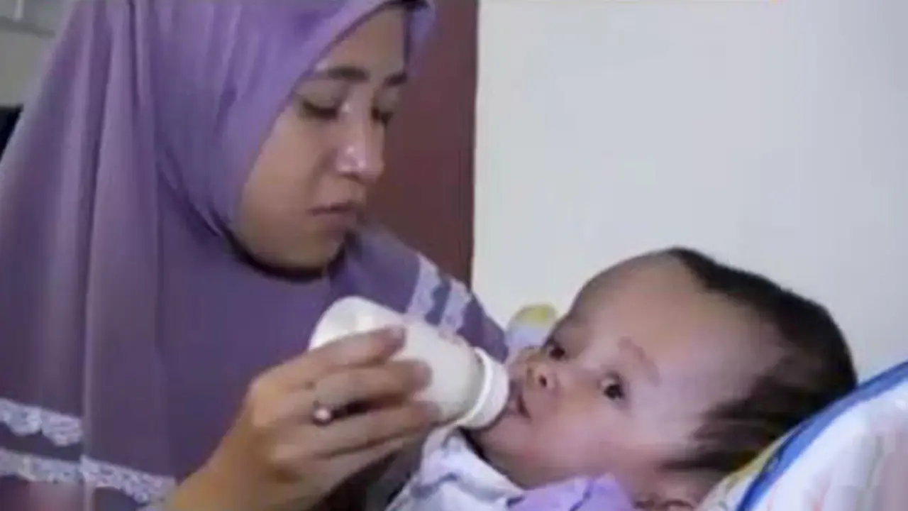 Pantang Menyerah: Kegigihan Ibu Rawat Anak Penderita Hidrosefalus